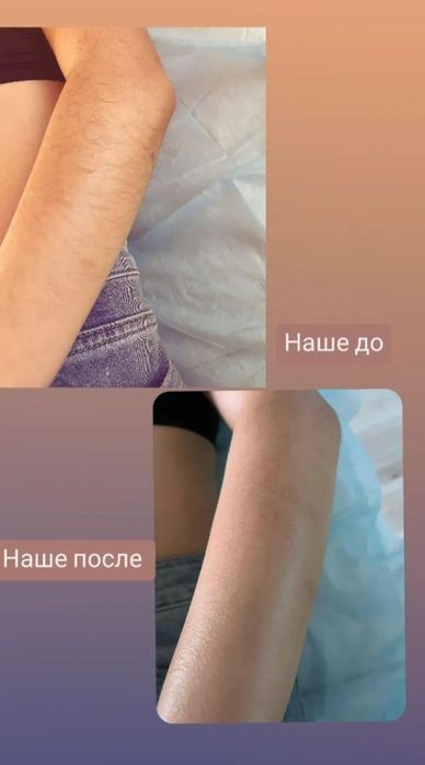 Женский шугаринг воском