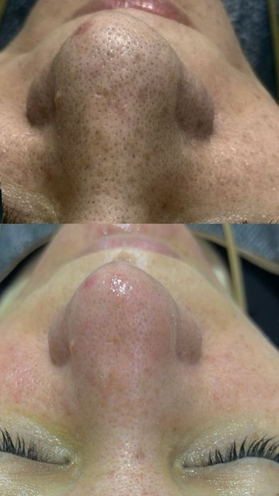 Косметология для женщин и мужчин  лазерная эпиляция