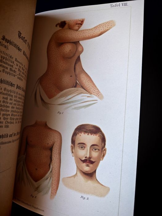 Carte veche medicină germană Platen (c. 1900) - Model anatomic complet