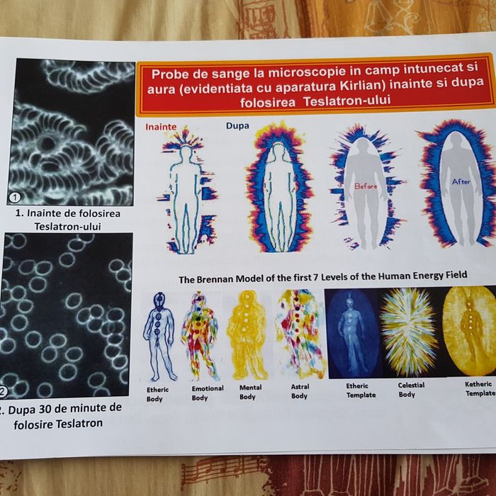 Teslatron aparat de terapie in cimp electrostatic