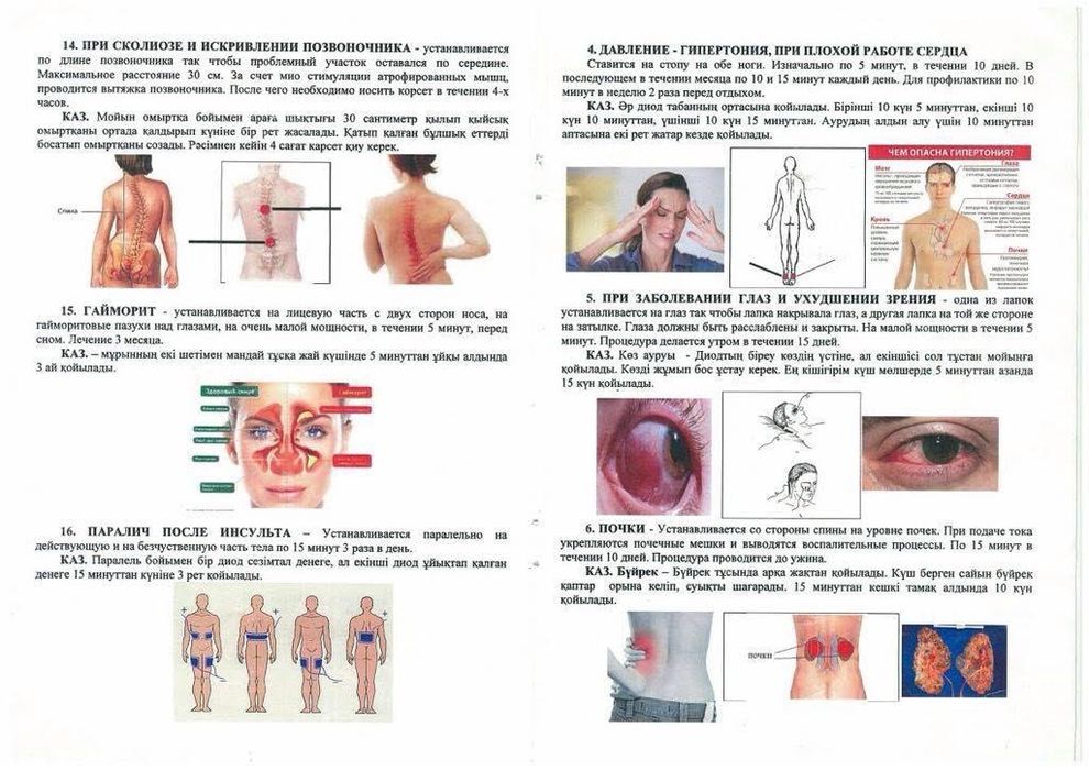 Массажный аппарат