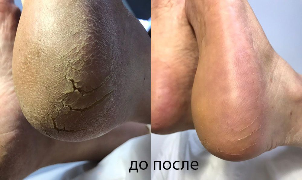 Маникюр и педикюр с выездом на дом