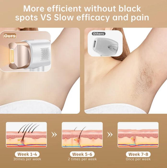 Продается Фотоэппилятор IPL FZ-608