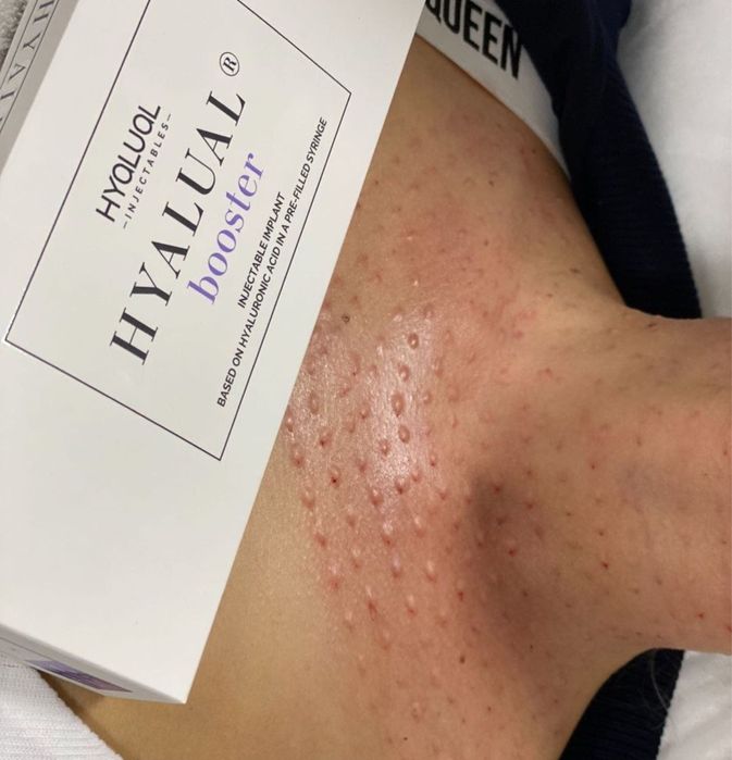 Косметолог шошиламиз кизлажонла декабр ойга  котта скидка