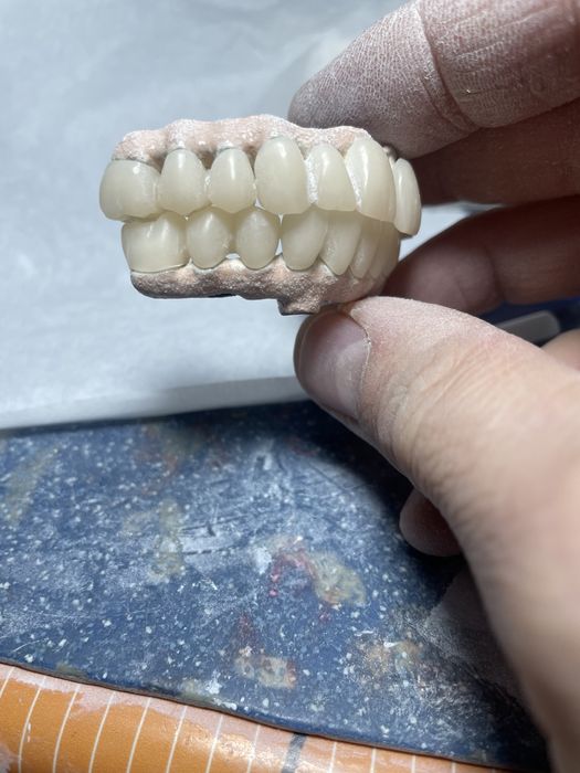 Tehnica dentara cursuri ExocadHyperdent(2,4/3.0/3,1)