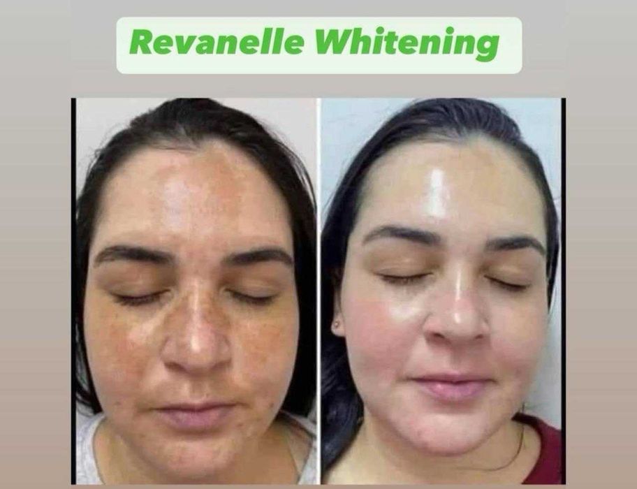 Kosmetolog | Yuzni tozalash, parvarish, pilinglar | OLMAZOR