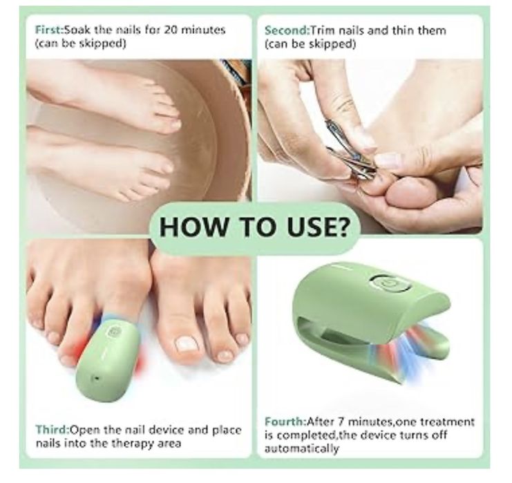 Dispozitiv de tratament cu laser pentru ciuperca unghiilor iKeener