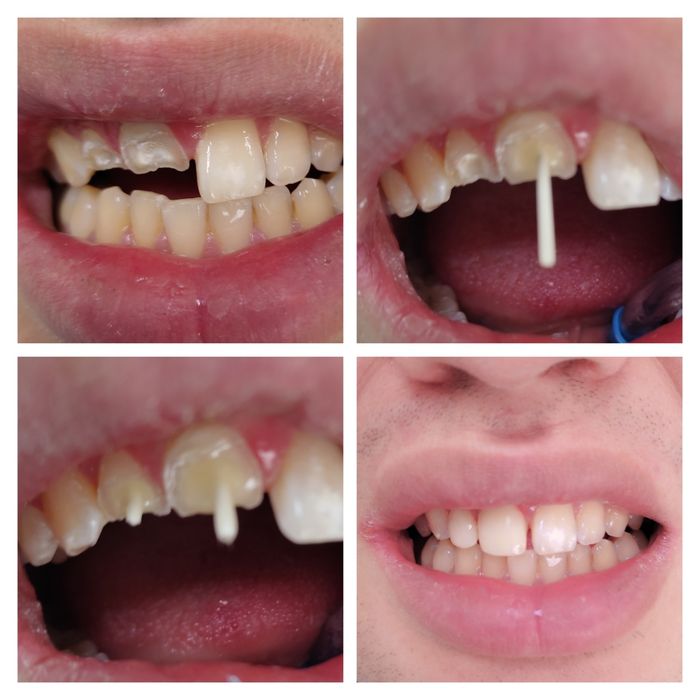 Услуги стоматолога