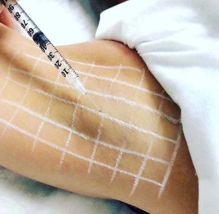 Косметолог шошиламиз кизлажонла декабр ойга  котта скидка