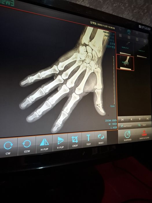 Партотивный рентгенный аппарат