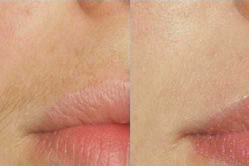 Шугаринг/воск для женщин