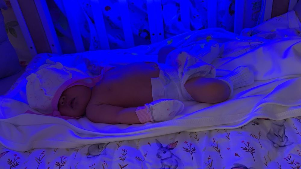 ФОТОЛампА. ЖелтушкА.