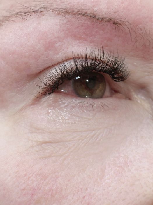 Aplic extensii gene 1D–3D | Rezultat natural & rezistent |