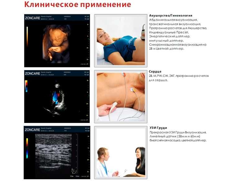 УЗИ-сканер (цифровой стационарный Zoncare-Q7)
