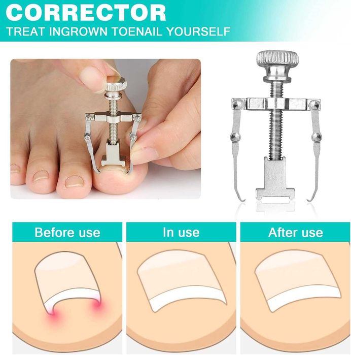 Комплект инструменти за педикюр – нокторезачки за дебели и впити нокти