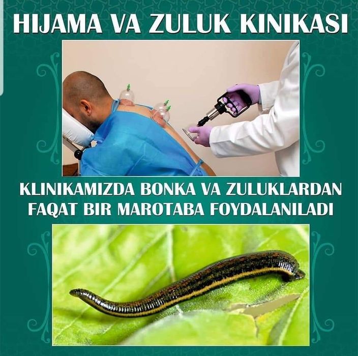 тиббий зулуклар медицинский пиявки