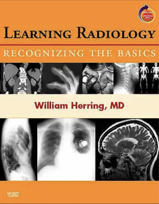Learning Radiology: Recognizing the Basics