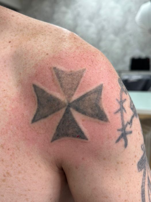 Удаление тату и татуажа