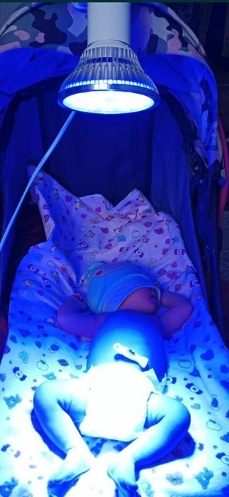 лампа от желтушки/ желтухи от 1000 тенге кувез / кювез / фонарь