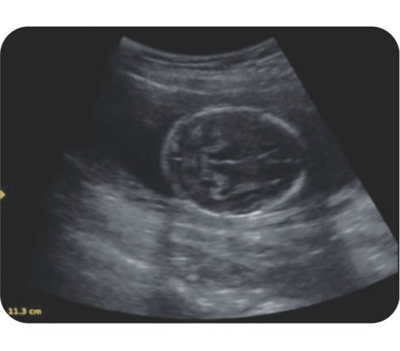 Узи аппарат Портативная ультразвуковая система K2