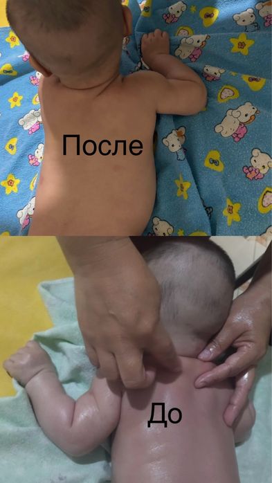 Сәбилер ( детский) емдік массаж парафин электрофорез