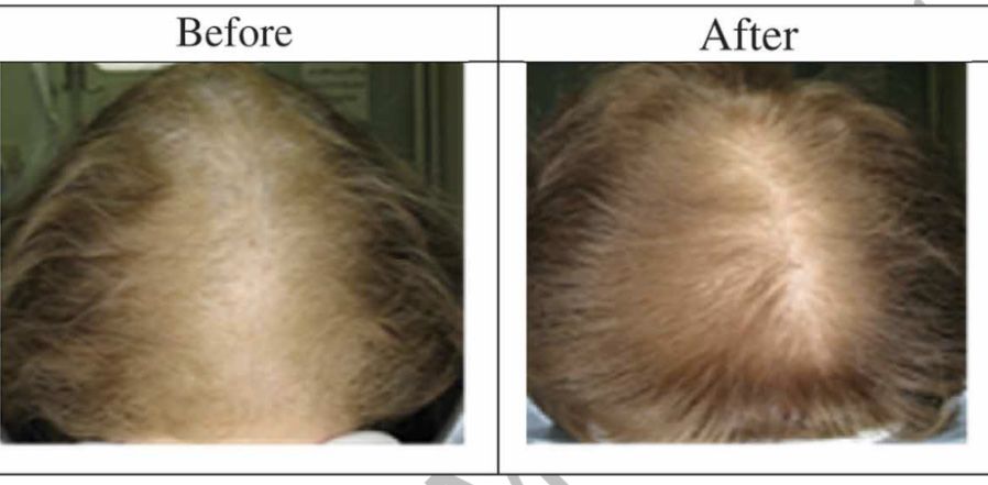 Лампа Красного Света