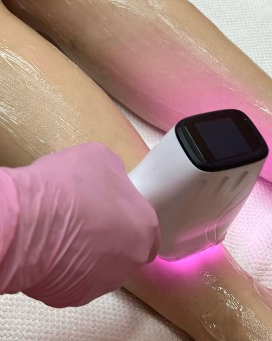 Epilare definitivă Oradea