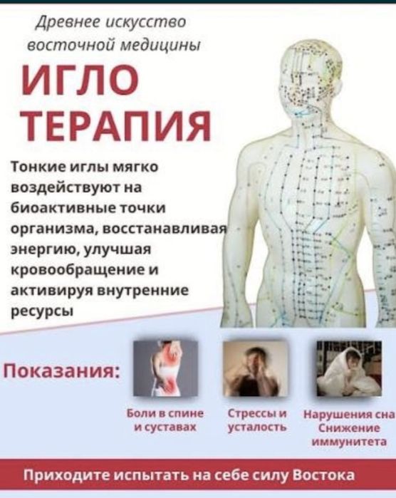 Инетерапиясы, иглоукалывание