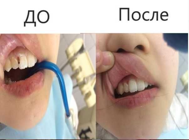 Опытный стоматолог г. Алматы