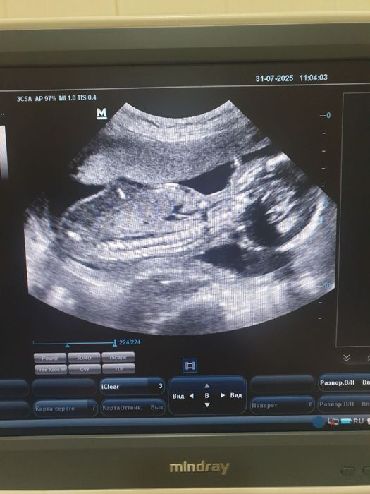 Узи аппарат Миндрей DC-N 3 (2016  года выпуска )