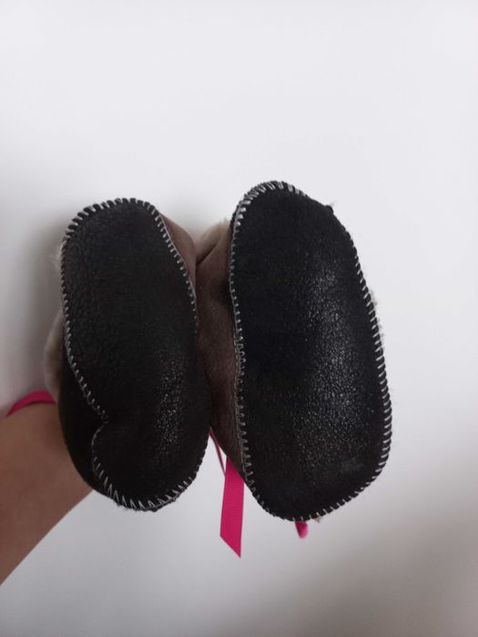 Botosei piele pentru bebe 1 an