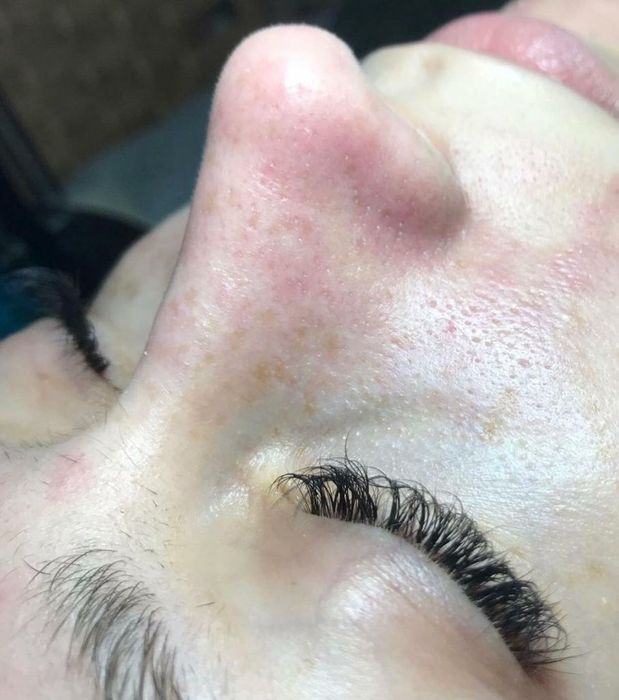 Услуги косметолога