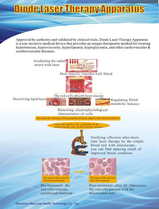 Dispozitiv medical terapie laser