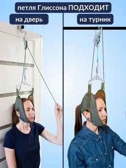 петля глиссона
