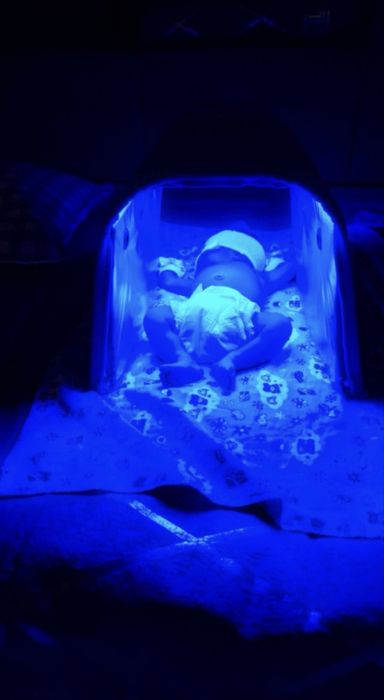 Лампа от желтушки