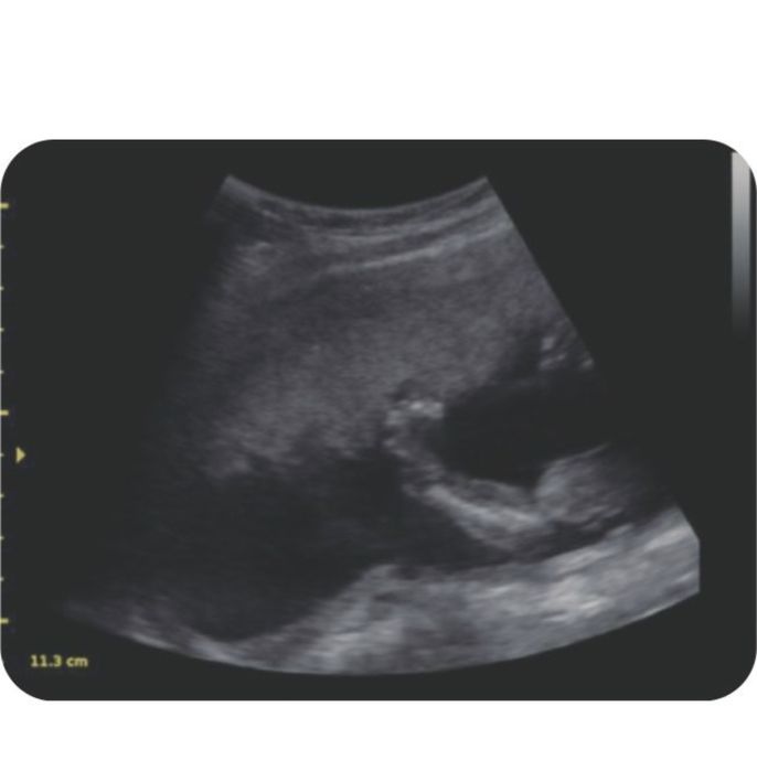 Узи аппарат Портативная ультразвуковая система K2