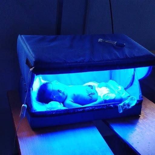 Фотолампа,чақалоқларда сариқликни уй шароитида самарали даволаймиз