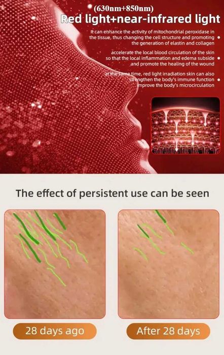 Маска за лице UBilli с LED светлина, 240 диода, домашна фототерапия