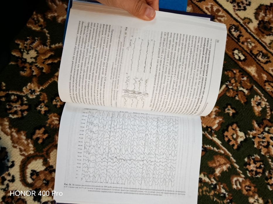 Книги по эпилептологии