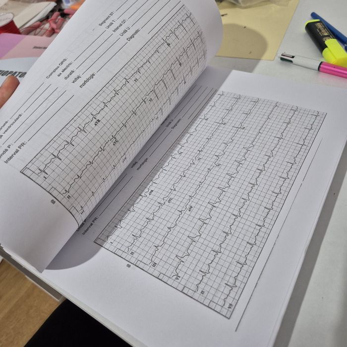 Ecg in 10 zile (copie)