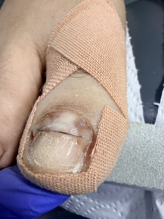 Этга усган тирноклар