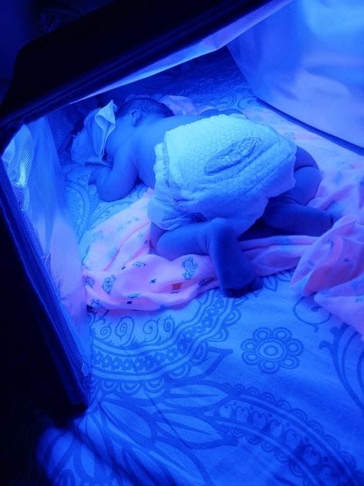 Лампа от желтушки