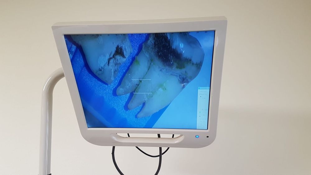Microscop stomatologic/ dentar/ endodontic