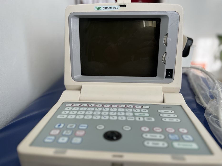Ecograf portabil Chison 600M