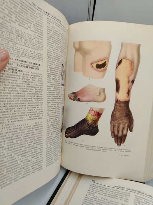Малая медицинская энциклопедия.