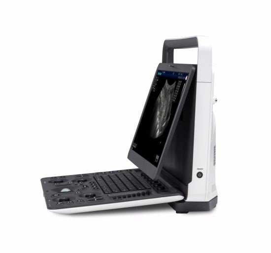 Новый УЗИ SonoScape E2 + 2 Датчика+Термопринтер РАССРОЧКА