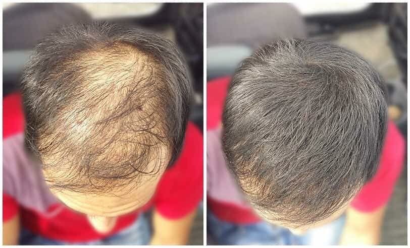 У нас настоящий Caboki Кабоки загуститель для волос