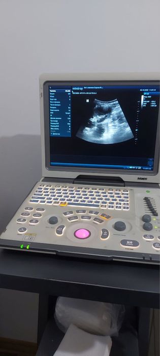 УЗИ аппарат Миндрай Dp-50