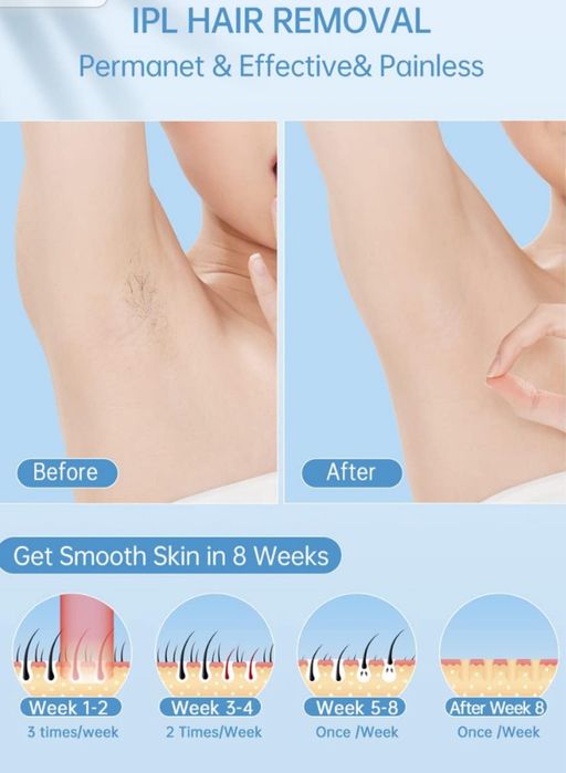 ZKMAGIC Dispozitive IPL Laser ! Sigilat !