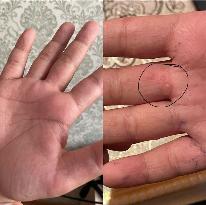 Тері аураларына қолдан қайнатылады